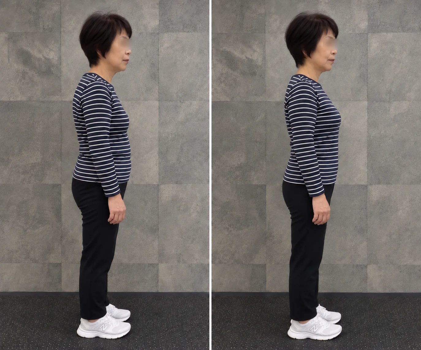 同じ女性の横向きの立ち姿を8か月の間隔で並べた写真